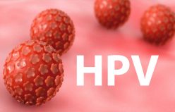 درمان قطعی زگیل تناسلی HPV